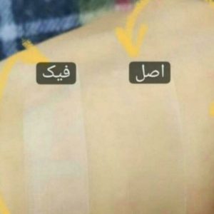 چسب لیفت بینی