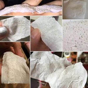 چسب از بین برنده جوش سر سیاه بینی
